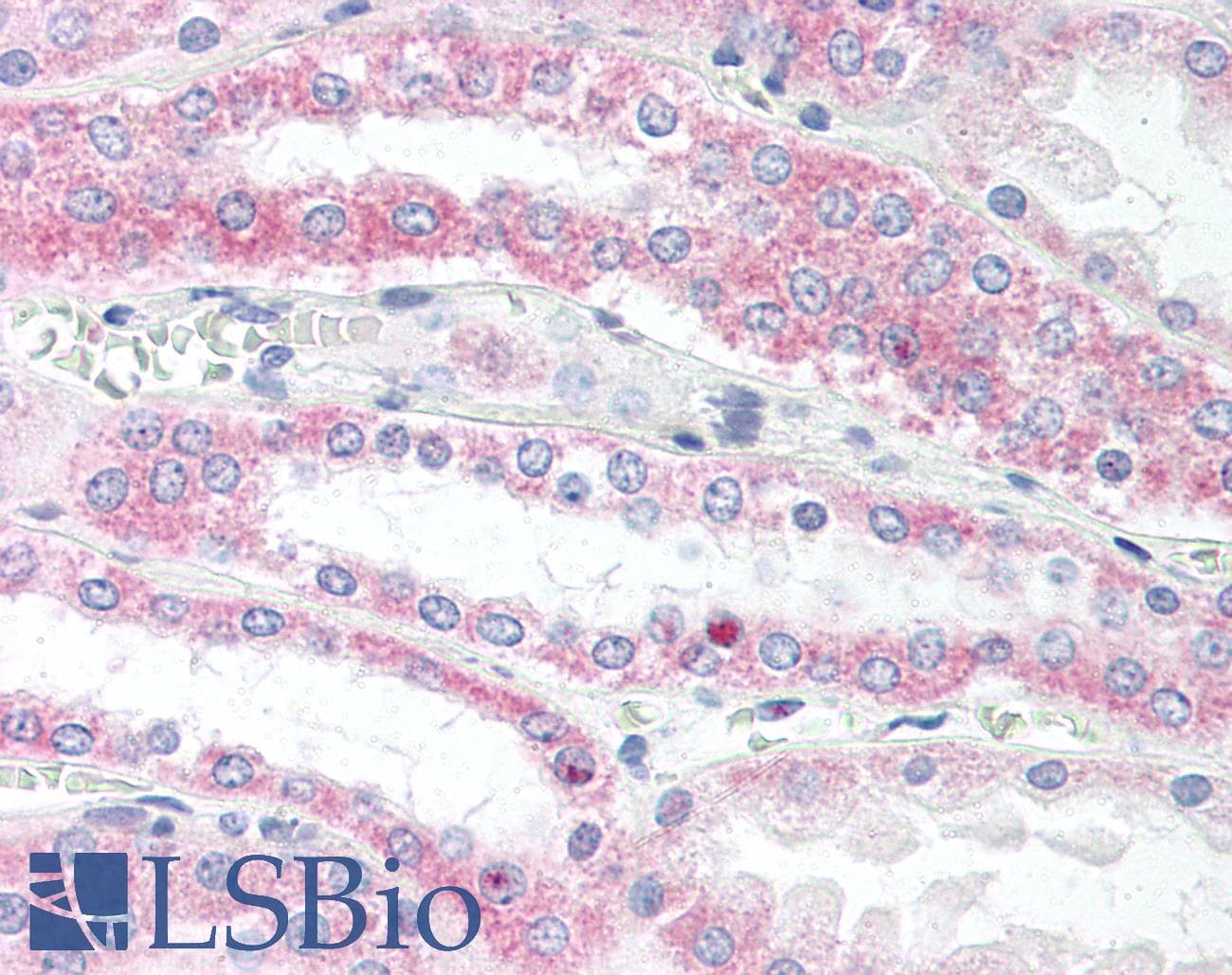 IHC-plus™ VAMP5 / VAMP-5 Antibody (N-Terminus)