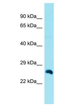 LRP5L Antibody (aa140-189)