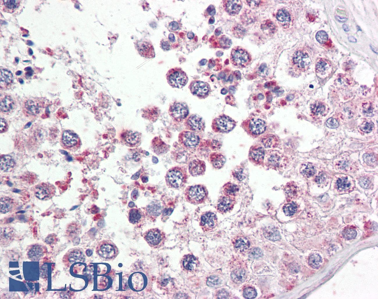 IHC-plus™ UIMC1 / RAP80 Antibody (aa535-548)