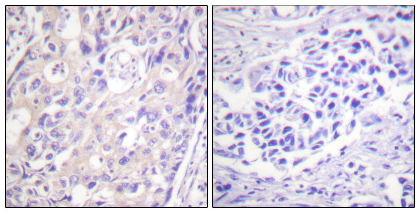 Polyclonal Rabbit anti-Human RPS6KA1 / RSK1 Antibody (phospho-Thr359+Ser363, IHC, WB)