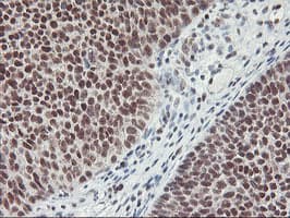 Monoclonal Mouse anti-Human RNF113B Antibody (clone OTI7A1, IHC, IF, WB)