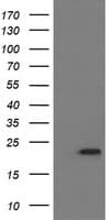 Monoclonal Mouse anti-Human LZIC Antibody (clone OTI1D5, IHC, WB)