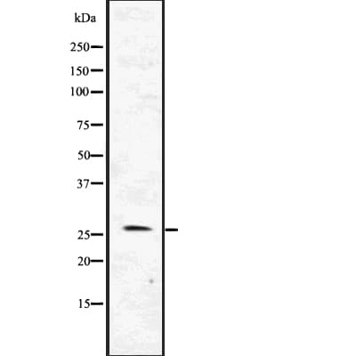 FLT3LG / Flt3 Ligand Antibody