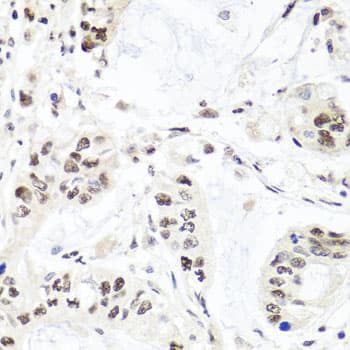 EXO1 Antibody