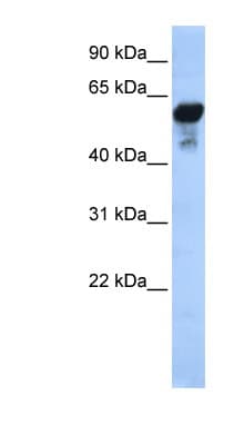 ALDH1B1 Antibody (aa395-444)