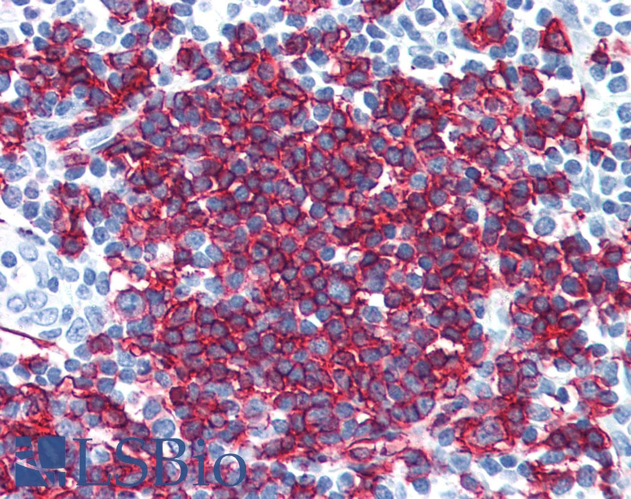 PathPlus™ CD20 Antibody (C-Terminus)