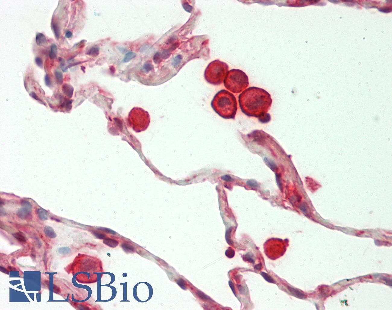 MYL6 Antibody (N-Terminus)
