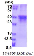 Human ST3GAL5 / GM3 Synthase Protein (Recombinant His)