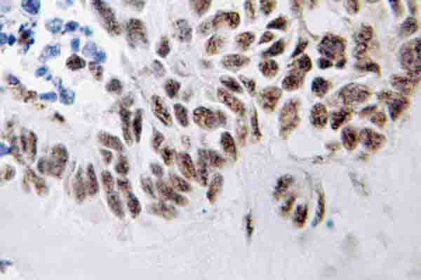 DAPK3 / ZIP Kinase Antibody (Lys261)
