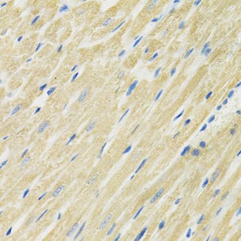 Polyclonal Rabbit anti-Human SLC19A1 Antibody (IHC, WB)