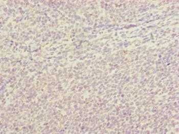 HAUS8 Antibody