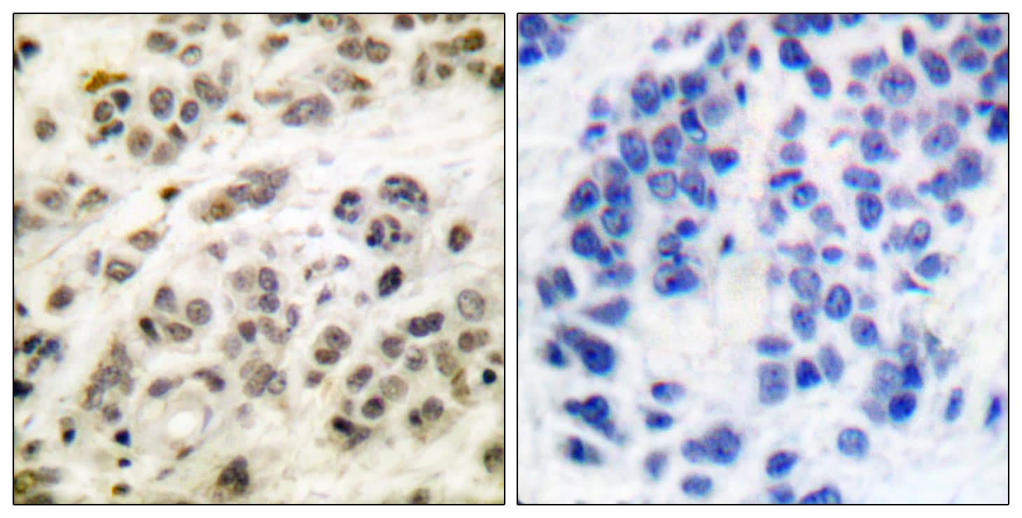 Polyclonal Rabbit anti-Human MYC / c-Myc Antibody (aa31-80, IHC, IF, WB)