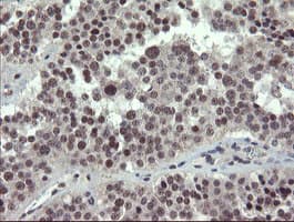 ZBED1 / TRAMP Antibody (clone OTI5A2)