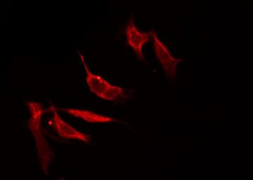 Polyclonal Rabbit anti-Human SLC17A2 Antibody (IF, WB)