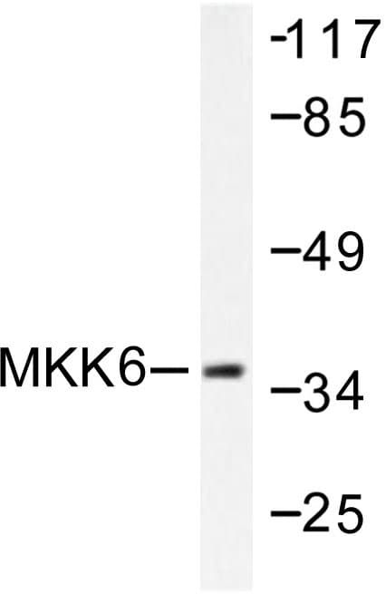 Polyclonal Rabbit anti-Human MAP2K6 / MEK6 / MKK6 Antibody (Ser201, IHC, WB)