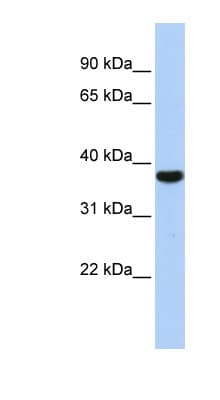 Polyclonal Rabbit anti-Human EXOSC2 / RRP4 Antibody (aa143-192, WB)