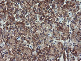 Monoclonal Mouse anti-Human VBP1 Antibody (clone OTI2C2, IHC, WB)