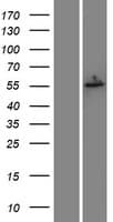 ESR2 / ER Beta Protein (Over-Expression Lysate Myc-DDK (Flag))
