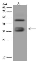FOLR1 / Folate Receptor Alpha Antibody (Preservative Free)