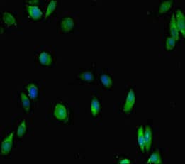 IKZF1 / IKAROS Antibody