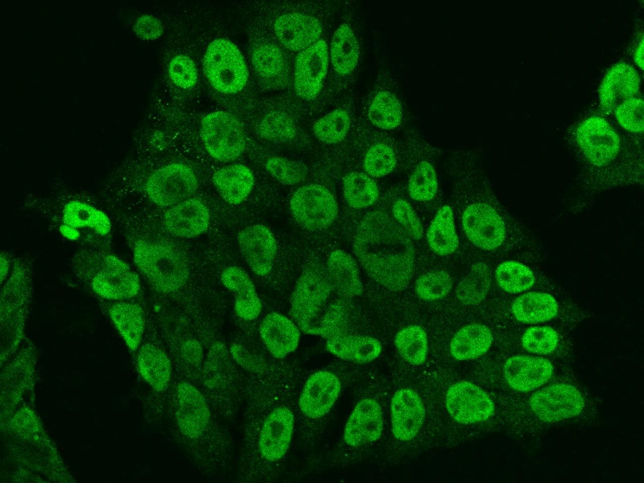 SALL4 Antibody