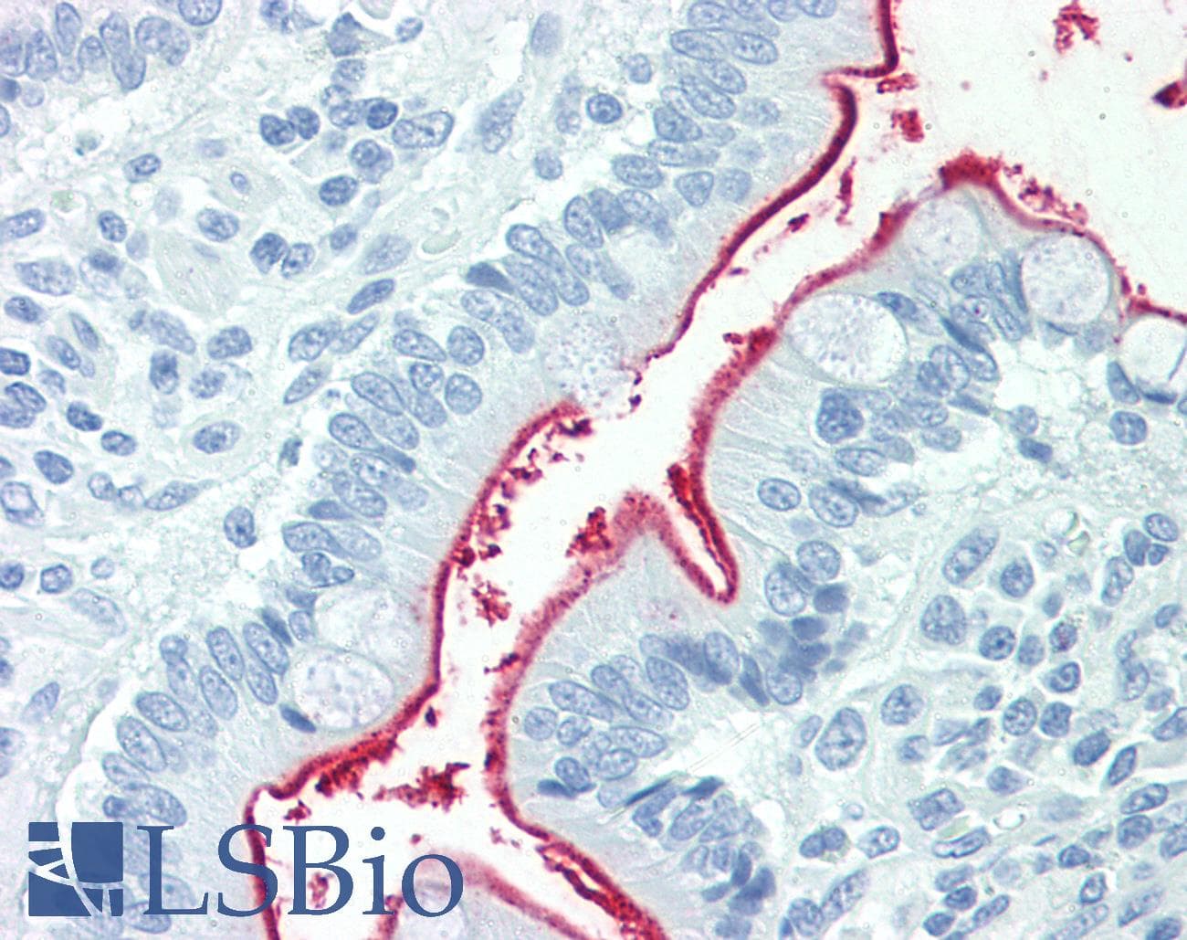 IHC-plus™ NPC1L1 Antibody (Internal)