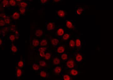 TADA2L / ADA2A Antibody