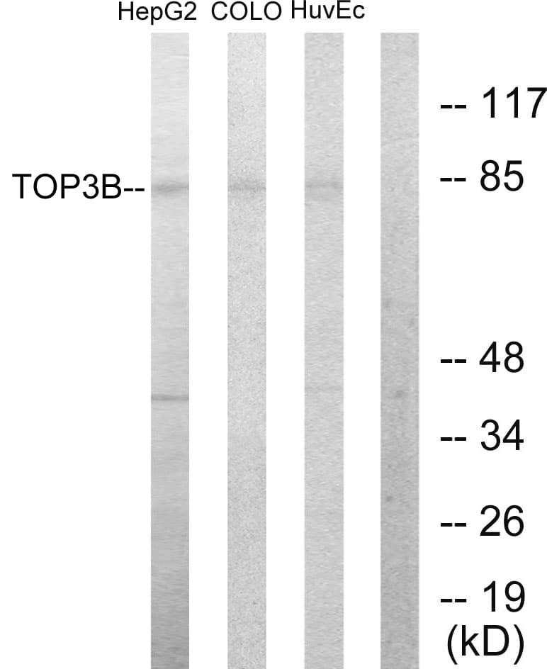 TOP3B Antibody (aa51-100)