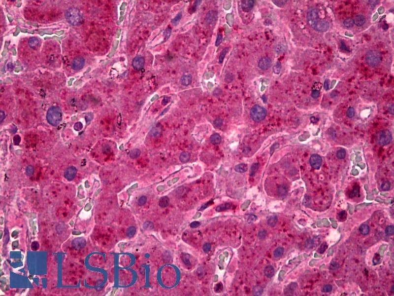 IHC-plus™ LDHA / LDH1 Antibody