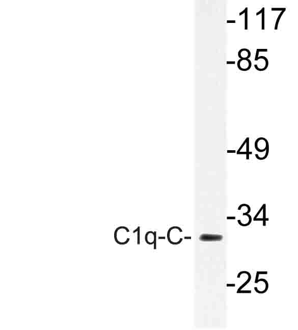 Polyclonal Rabbit anti-Human C1QG / Complement C1QC Antibody (Gln119, IHC, WB)