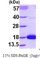 Human CDA / Cytidine Deaminase Protein (Recombinant His)