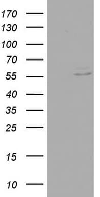 RIPK3 / RIP3 Antibody (aa233-518, clone OTI3A12)