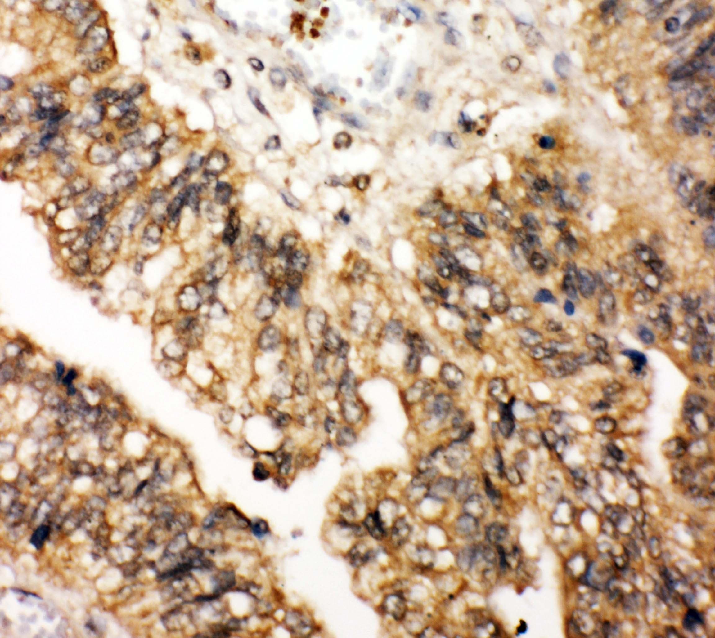 Polyclonal Rabbit anti-Human LPXN / Leupaxin Antibody (aa115-129, IHC, WB)