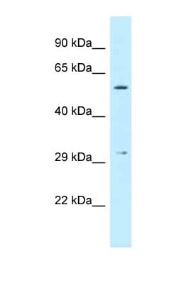 CRISPLD1 Antibody (aa206-255, HRP)