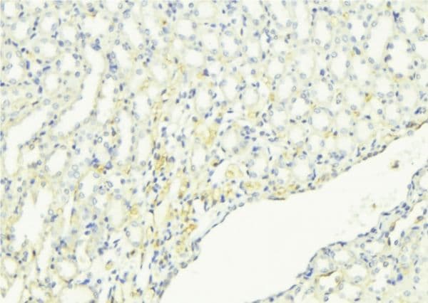 DMTN / Dematin Antibody