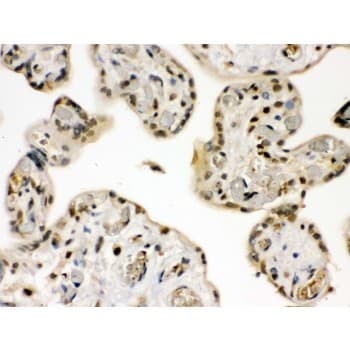GRK5 Antibody (aa393-429)
