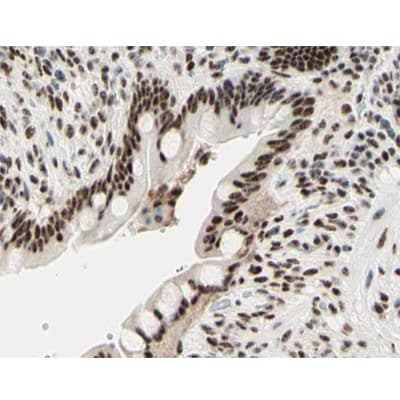 Polyclonal Rabbit anti-Human Histone H3.1 Antibody (phospho-Ser10, IHC, WB)