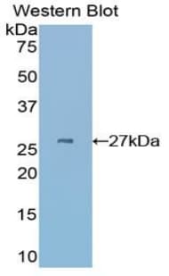 CYR61 Antibody (aa176-379)