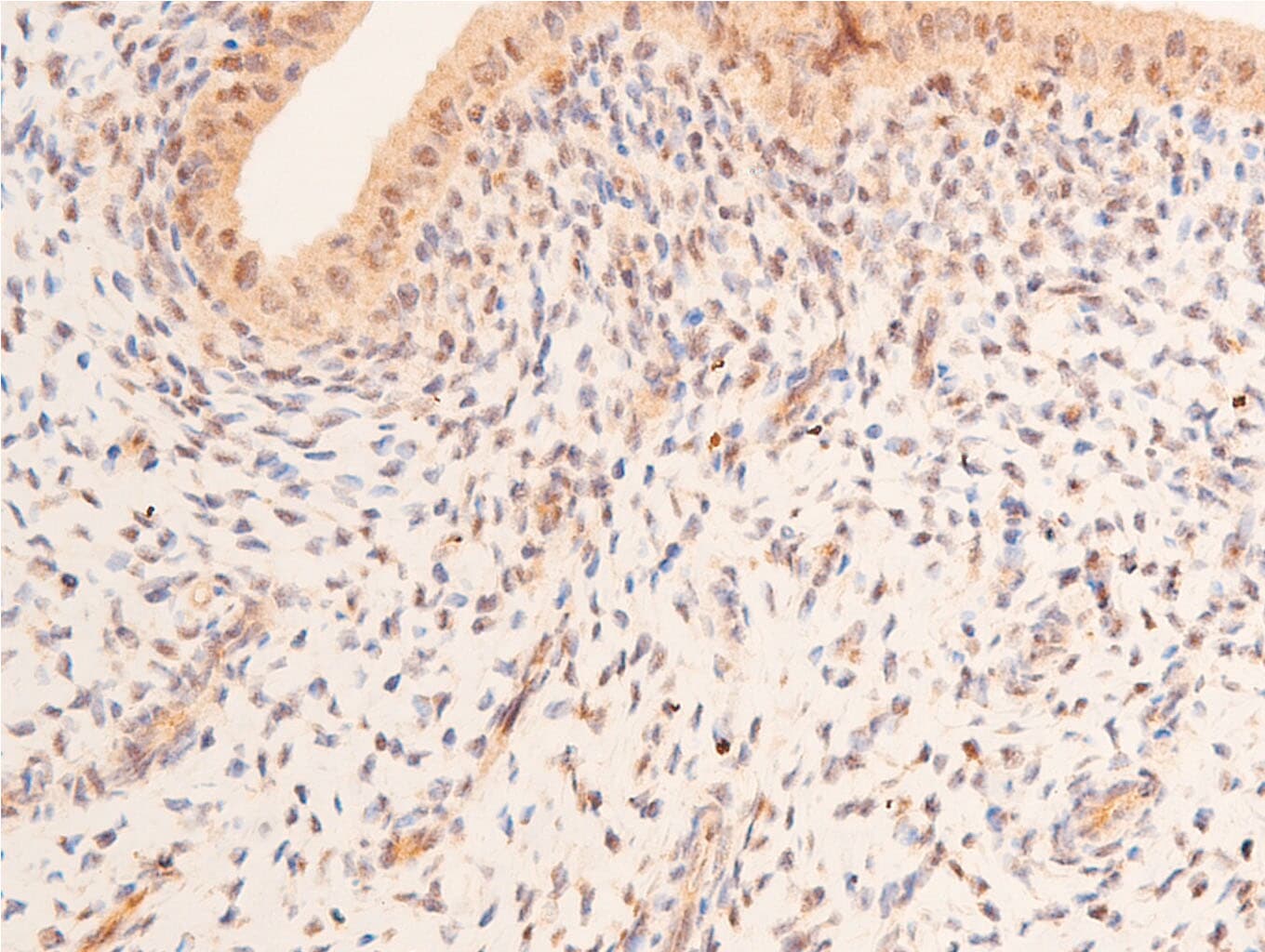 TP53 / p53 Antibody (Acetyl-Lys317)