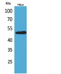 Basigin / Emmprin / CD147 Antibody