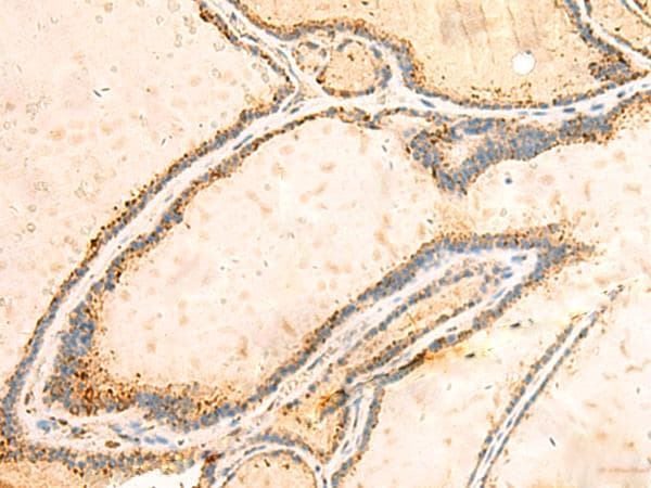 IGFBPL1 Antibody