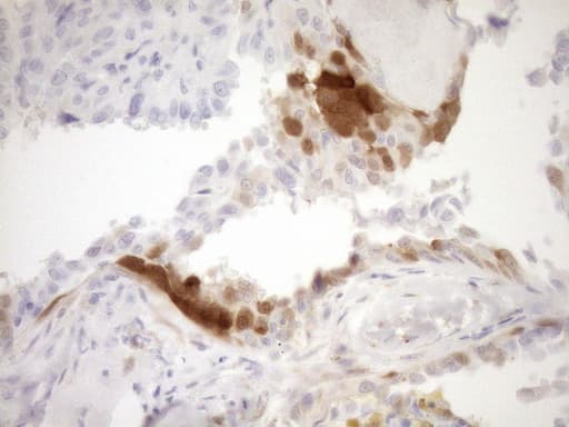 p16INK4a / CDKN2A Antibody (clone OTI1H3)
