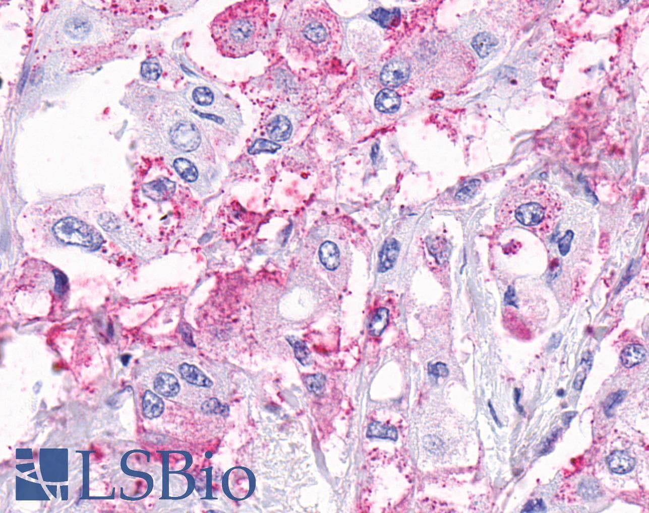 PathPlus™ ADGRA2 / GPR124 Antibody (N-Terminus)