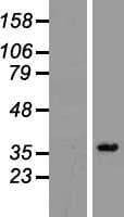 PPA2 Protein (Over-Expression Lysate Myc-DDK (Flag))