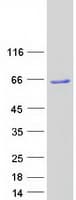 Human FLJ22028 Protein (Recombinant Myc-DDK (Flag))