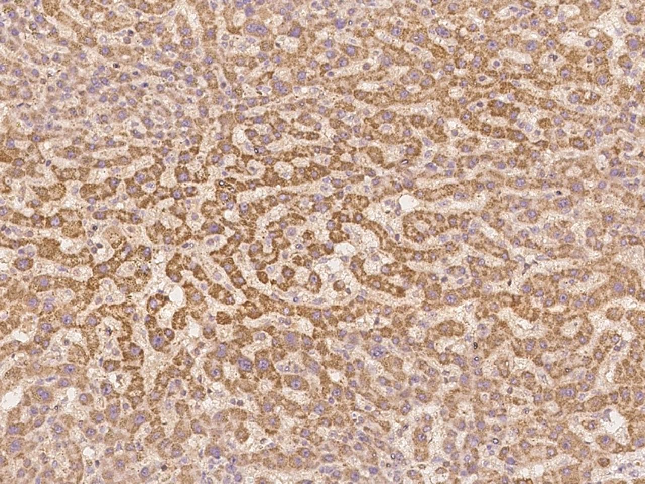 G0S2 Antibody
