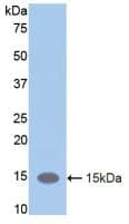 CD118 / LIF Receptor Alpha Antibody (aa381-485)