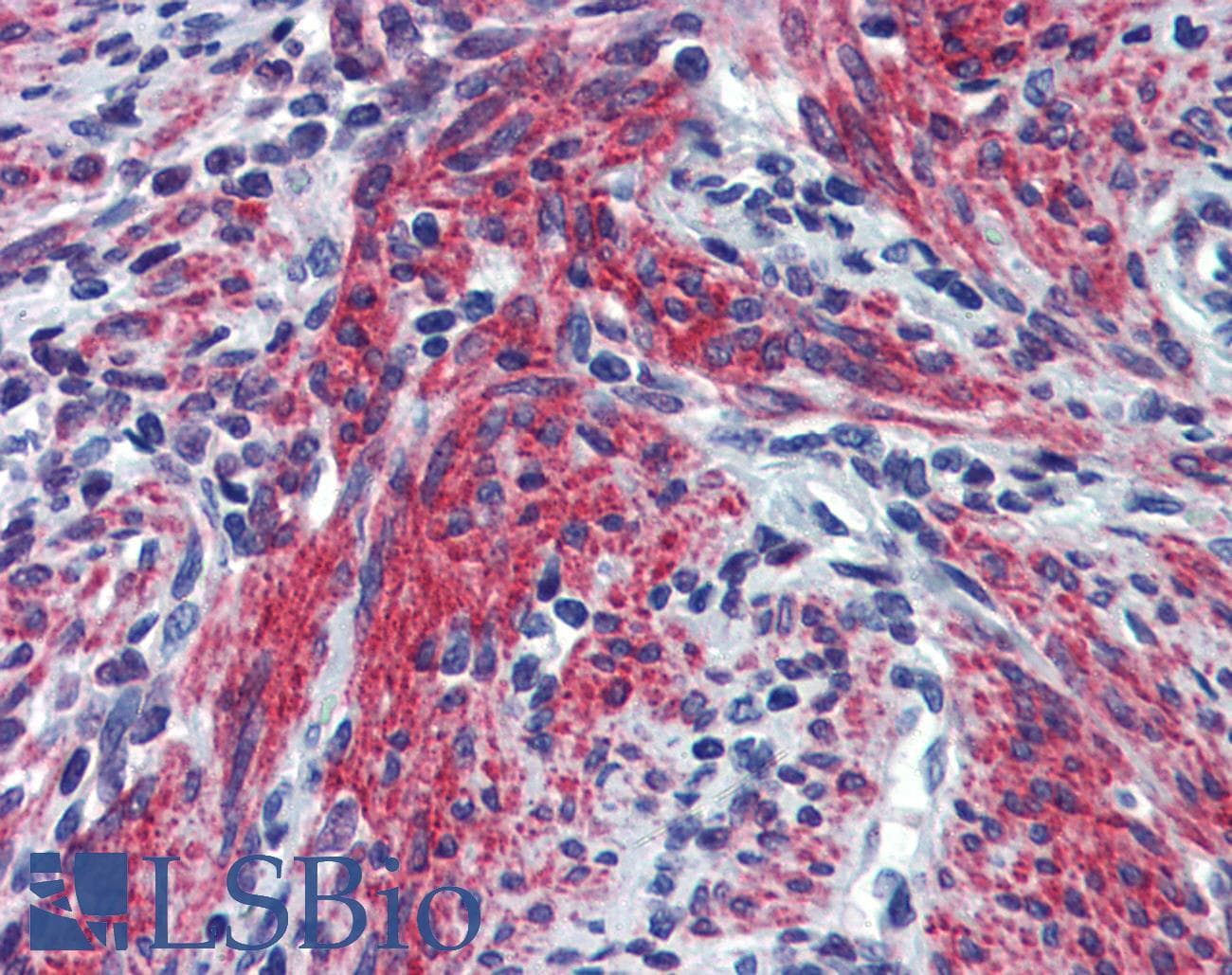 POSTN / Periostin Antibody (C-Terminus)