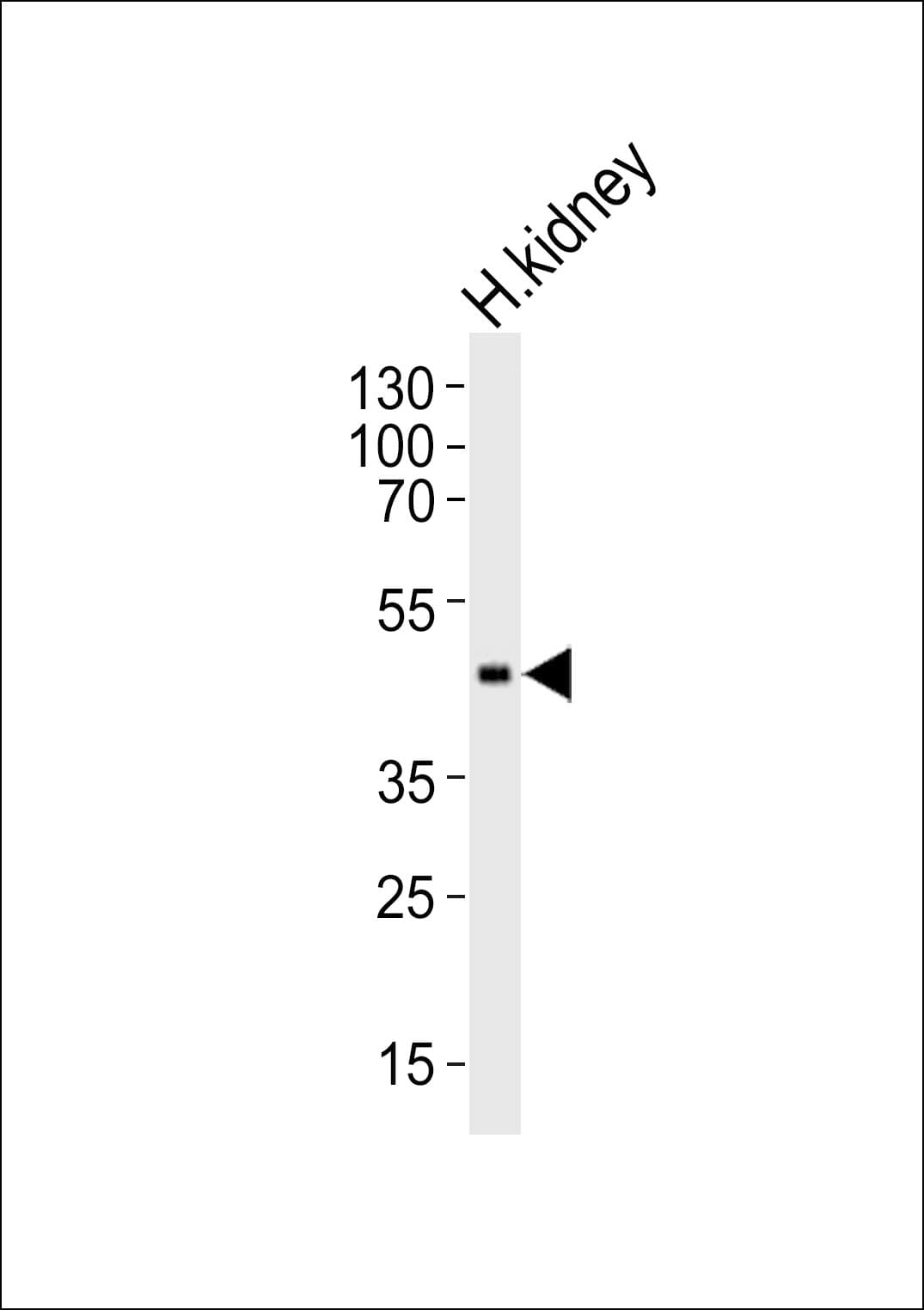IHC-plus™ Polyclonal Rabbit anti-Human CPM / Carboxypeptidase M Antibody (aa212-241, IHC, WB)
