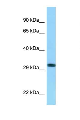 RHD Antibody (aa165-214)